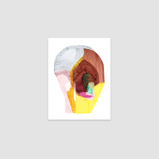 Fièvre